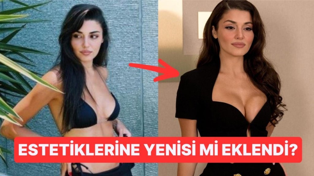 Estetiklerine Bir Yenisi Eklendi: Hande Erçel’in Eski Hali Meme İmplantını Akıllara Getirdi