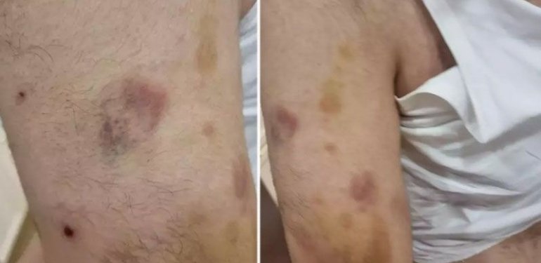 Otizmli gence dayak iddiasına ilk duruşmada tahliye