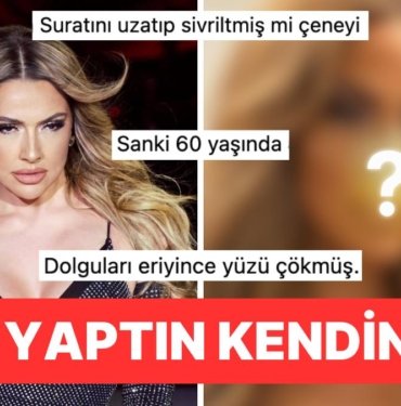 Hadise’den Jet Hızıyla Geri Vites: Fotoğrafını Paylaştı, “Yüzüne Ne Oldu?” Yorumları Yağınca Anında Sildi!