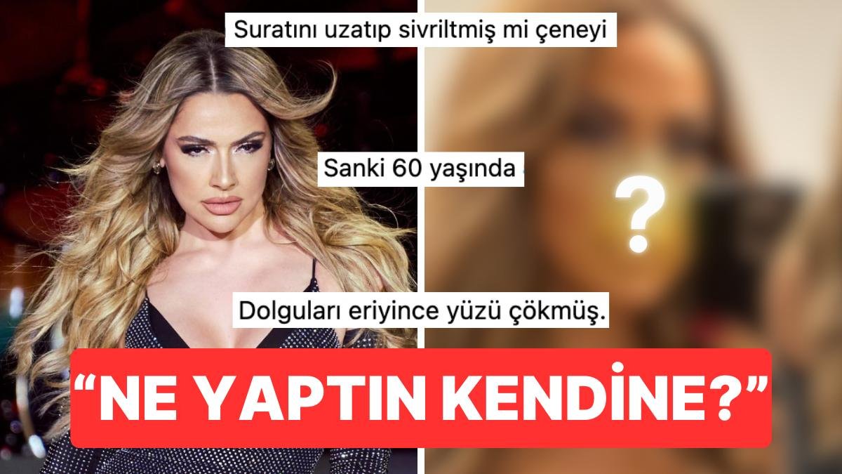 Hadise’den Jet Hızıyla Geri Vites: Fotoğrafını Paylaştı, “Yüzüne Ne Oldu?” Yorumları Yağınca Anında Sildi!