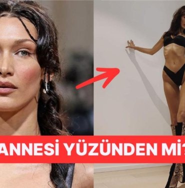 Yemek Yemek Yerine Bir Avuç Vitaminle Beslenen Bella Hadid’in Son Videosu Endişelendirdi