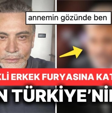 Biraz Fazla Olmadı mı? Yüz Gerdirme Ameliyatı Olan Cenk Eren’in Kendisini Benzettiği Ünlü Epey Şaşırttı!