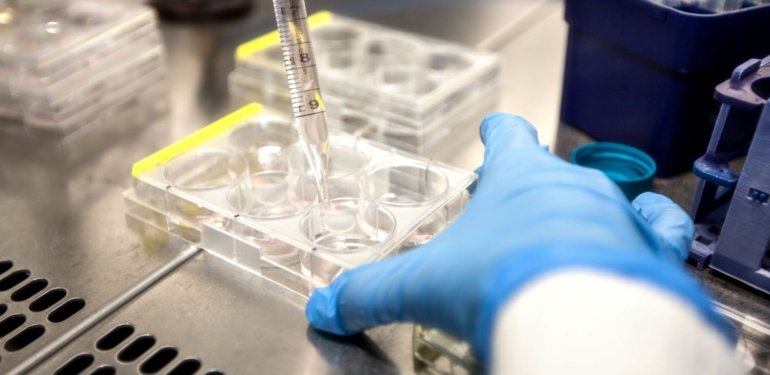 AIDS’te yeni umut: “Genetik makas” ile HIV tedavisi