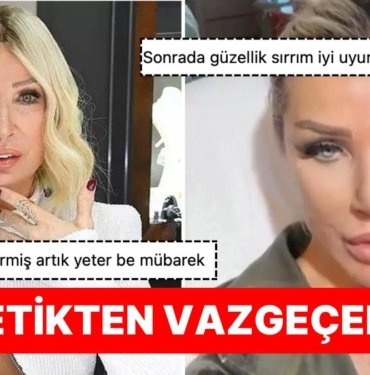 Güzellik Uğruna Her Şeyi Göze Alan Seda Sayan Yüzüne ve Göğüs Dekoltesine Yine Sünnet Derisi Enjekte Ettirdi!