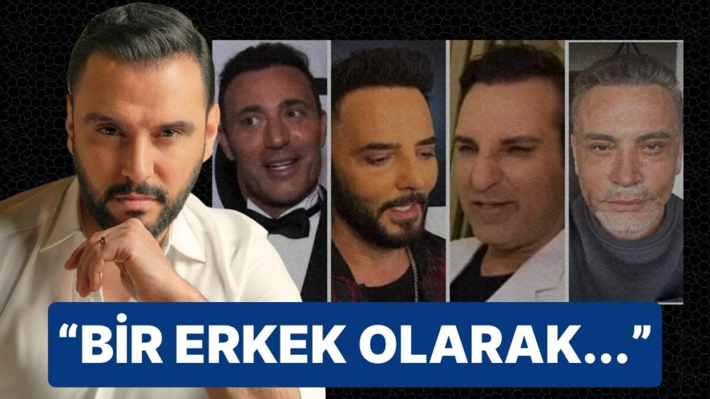 Alişan’dan Estetik Furyasına Katılan Hemcinsi Meslektaşlarına Ders!