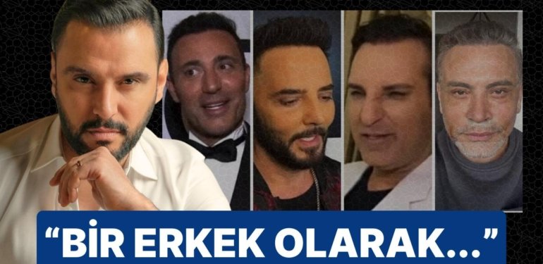Alişan’dan Estetik Furyasına Katılan Hemcinsi Meslektaşlarına Ders!