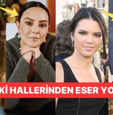 O Eski Halinden Eser Yok Şimdi! Yaptırdıkları Estetikler ile Bambaşka Birine Dönüşen Ünlü İsimler
