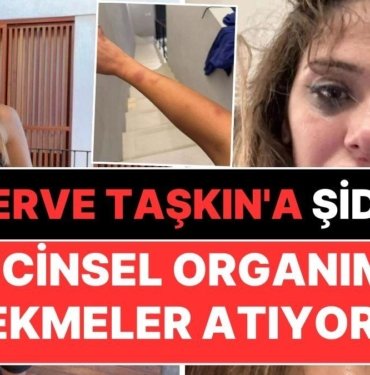 Merve Taşkın Sevgilisinden Gördüğü Şiddeti Paylaştı: “Cinsel Organıma Tekmeler Atıyordu”