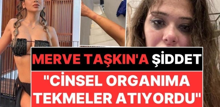 Merve Taşkın Sevgilisinden Gördüğü Şiddeti Paylaştı: “Cinsel Organıma Tekmeler Atıyordu”