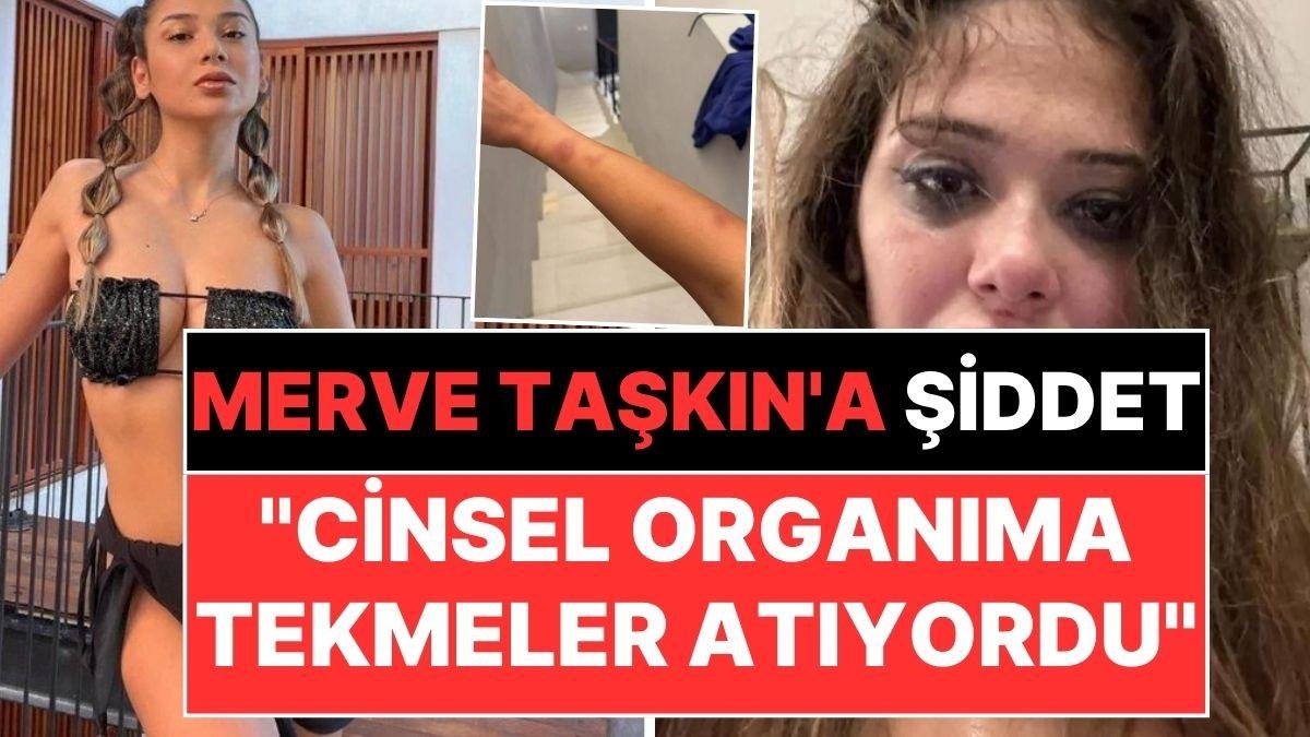 Merve Taşkın Sevgilisinden Gördüğü Şiddeti Paylaştı: “Cinsel Organıma Tekmeler Atıyordu”