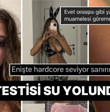 Eski Sevgilisinden Şiddet Gören OnlyFans Fenomeni Merve Taşkın’a Gelen İnsanlık Dışı Yorumlar!