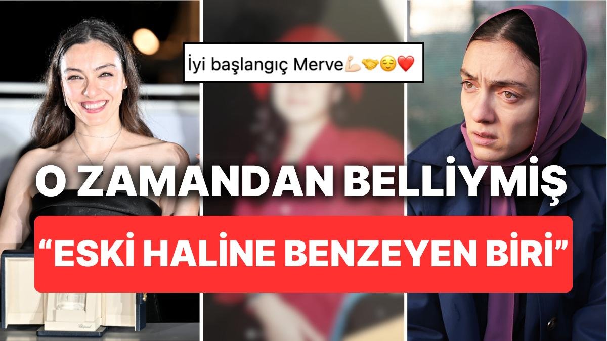 Merve Dizdar 17 Yaşından Bir Fotoğraf Paylaştı: O Zamandan Belliymiş!