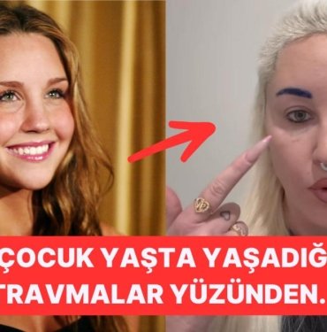 Bir Zamanlar Parlayan Bir Yıldızken Şimdi Hollywood’dan Silinip Giden Amanda Bynes’ın Üzücü Değişimi