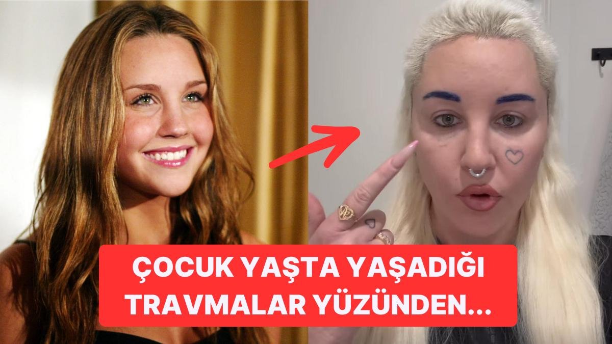 Bir Zamanlar Parlayan Bir Yıldızken Şimdi Hollywood’dan Silinip Giden Amanda Bynes’ın Üzücü Değişimi