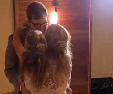 Yapışık ikizler evlendi! Çocuk sahibi olmak istiyorlar