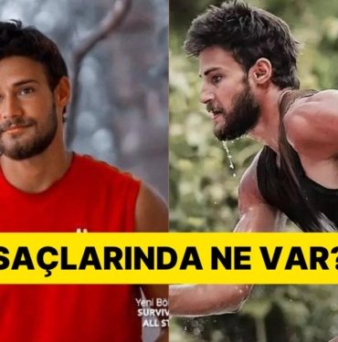 Survivor Batuhan Karacakaya’nın Saçlarıyla İlgili Detay Gündem Oldu!