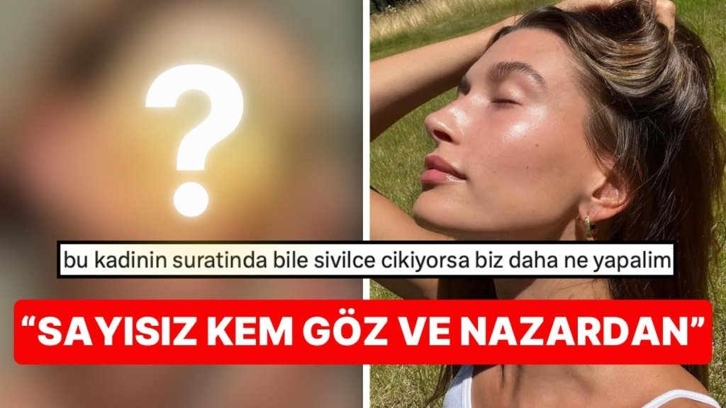 El Birliği İle Nazar Değdirdik! Cam Gibi Cildiyle Nam Salmış Model Hailey Bieber Yüzünün Geldiği Hali Paylaştı