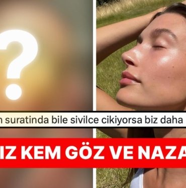 El Birliği İle Nazar Değdirdik! Cam Gibi Cildiyle Nam Salmış Model Hailey Bieber Yüzünün Geldiği Hali Paylaştı