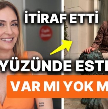 Ceyda Düvenci'den de Estetik İtirafı Geldi! Peki Ceyda Düvenci'nin Yüzünde Ne Var? 3 Ceyda Düvenci’den de Estetik İtirafı Geldi! Peki Ceyda Düvenci’nin Yüzünde Ne Var?
