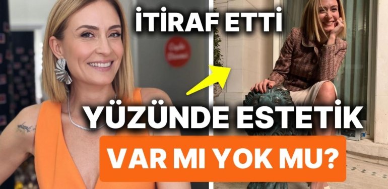 Ceyda Düvenci’den de Estetik İtirafı Geldi! Peki Ceyda Düvenci’nin Yüzünde Ne Var?