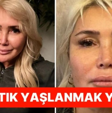 Sünnet Derisinden Sonra Yeni Moda mı Geliyor? Yonca Evcimik’in Estetik İtirafı “Daha Neler Göreceğiz” Dedirtti