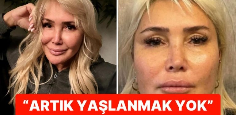 Sünnet Derisinden Sonra Yeni Moda mı Geliyor? Yonca Evcimik’in Estetik İtirafı “Daha Neler Göreceğiz” Dedirtti
