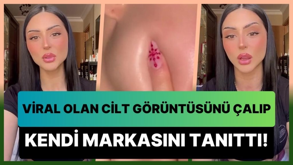 Influencerlara Neden Güvenmemeliyiz? 6 Milyon İzlenen Cilt Görüntüsünü Çalıp Kendi Ürününün Tanıtımını Yaptı!