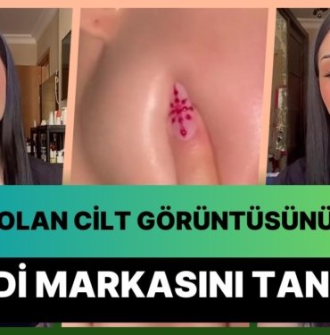 Influencerlara Neden Güvenmemeliyiz? 6 Milyon İzlenen Cilt Görüntüsünü Çalıp Kendi Ürününün Tanıtımını Yaptı!