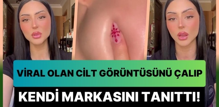Influencerlara Neden Güvenmemeliyiz? 6 Milyon İzlenen Cilt Görüntüsünü Çalıp Kendi Ürününün Tanıtımını Yaptı!