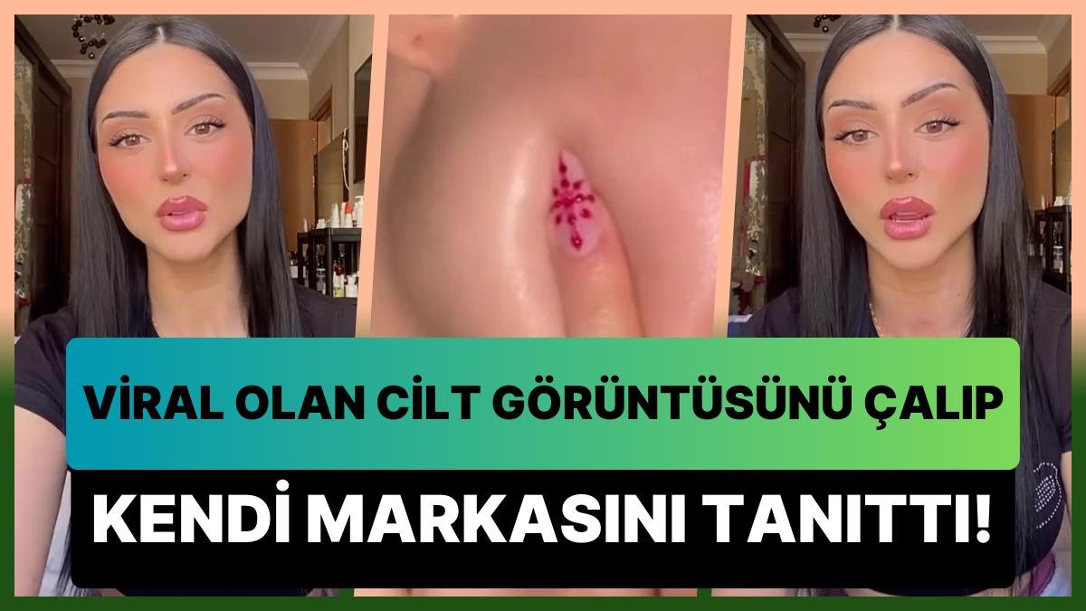 Influencerlara Neden Güvenmemeliyiz? 6 Milyon İzlenen Cilt Görüntüsünü Çalıp Kendi Ürününün Tanıtımını Yaptı!