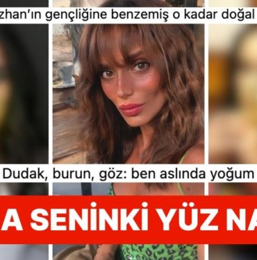 Estetikten Yıkılsa da “Estetiğe İhtiyaç Duymadım” Açıklaması Yapan Bestemsu Özdemir’in Değişimini İnceliyoruz