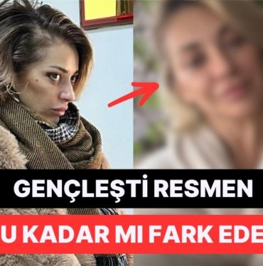 Seçim Sonuçlarını Duyan Feyza Altun Adeta Yeniden Doğdu: “Bende Botoks Etkisi Yaptı”