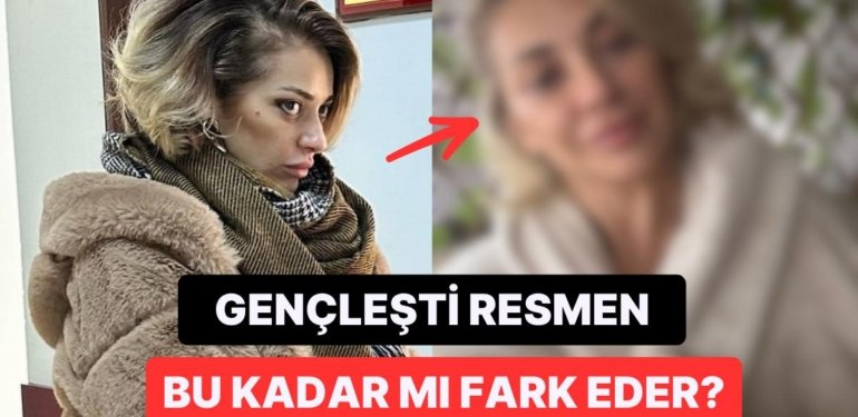 Seçim Sonuçlarını Duyan Feyza Altun Adeta Yeniden Doğdu: “Bende Botoks Etkisi Yaptı”