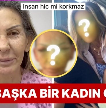 Petek Dinçöz Estetik Furyasına Annesini de Sürükledi: Annesi Gitti Başka Bir Kadın Geldi!