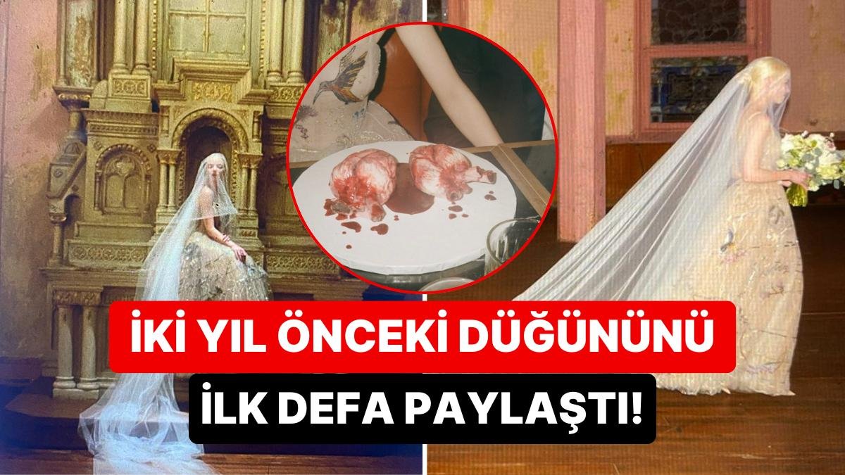 Ayin Havasında Bir Törenle Evlenen Anya Taylor-Joy’un Paylaştığı Düğün Kareleri Resmen Mideleri Alt Üst Etti