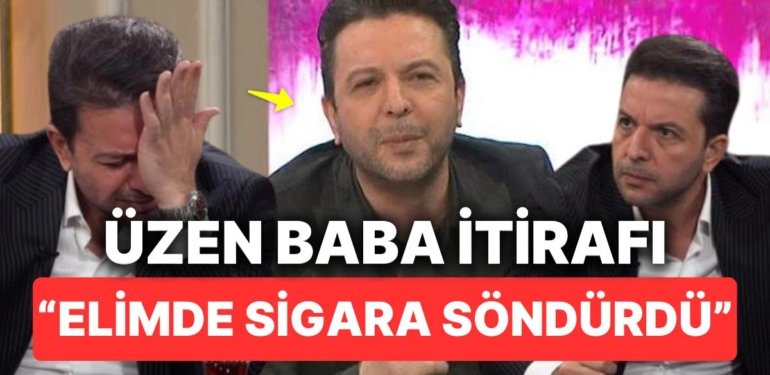 Babasından Kendisine Kalan Tek Şeyin Sigara Yanığı İzi Olduğunu Söyleyen Nihat Doğan’ın Acı İtirafı