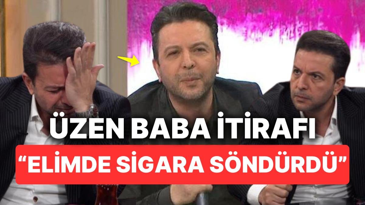 Babasından Kendisine Kalan Tek Şeyin Sigara Yanığı İzi Olduğunu Söyleyen Nihat Doğan’ın Acı İtirafı