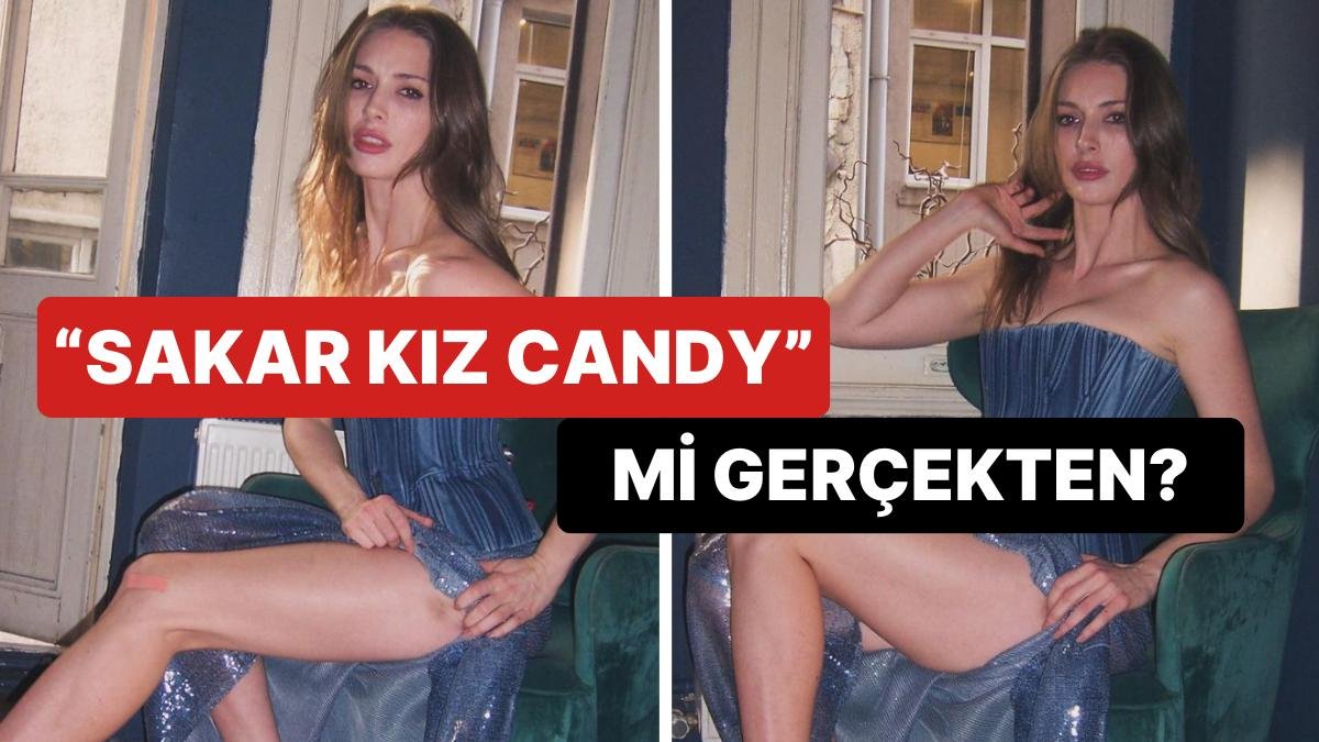 Vücudundaki Morlukları ve Jilet Kesiğini Göze Sokan Yasemin Allen Akıllara Sevgilisini Getirdi