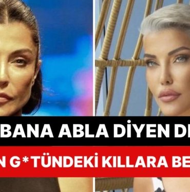 Küfürler Havada Uçuştu: Deniz Akkaya Kendisine “Abla” Diyen Takipçisine Verdiği Cevapla Dozu Fazla Kaçırdı!