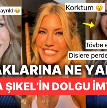Çağla Şıkel’in Bir Tarafı Hanya’ya Bir Tarafı Konya’ya Bakan Dudakları Hepimize Küçük Çaplı Bir Şok Yaşattı