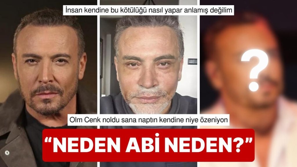 Değişimin de Böylesi: Estetik Modasına Uyup Yüz Gerdirme Ameliyatı Olan Cenk Eren Son Halini Paylaştı!