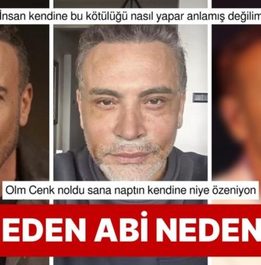 Değişimin de Böylesi: Estetik Modasına Uyup Yüz Gerdirme Ameliyatı Olan Cenk Eren Son Halini Paylaştı!