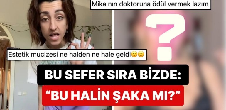 Cinsiyet Geçiş Sürecini Tamamlayan Mika Raun’un Son Hali Kelimeleri Kifayetsiz Bıraktı!