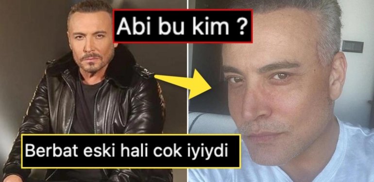Yüz Gerdirme Ameliyatı Olmuştu: Şarkıcı Cenk Eren’in Paylaştığı Yeni Fotoğrafı ‘Bu Kim Yahu?’ Dedirtti!