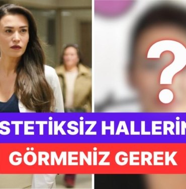 Yıllar İçinde Çok Değişmiş: Bahar Dizisinin Rengin’i Ecem Özkaya’nın Estetiksiz Halleri