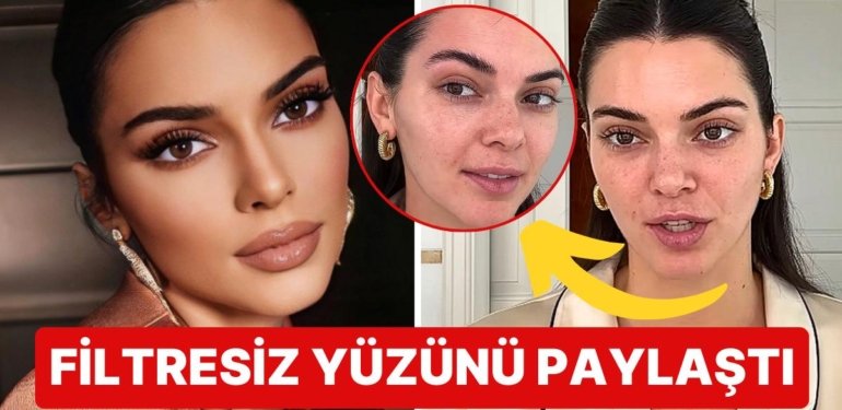 Kandırıldık! Bakım Rutinini Paylaşan Kendall Jenner’ın Videosundaki Cilt Kusurları “O da Bizim Gibi” Dedirtti