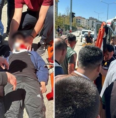 Otomobil yaya geçidinde çocuğa çarptı