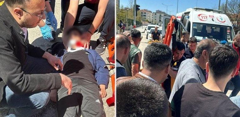 Otomobil yaya geçidinde çocuğa çarptı