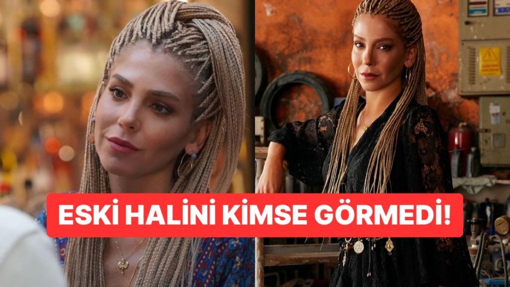 Şahane Hayatım’ın Didem’i Gökçe Eyüboğlu’nun Yalan Dünya’daki Estetiksiz Hali Şoke Etti!