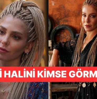 Şahane Hayatım’ın Didem’i Gökçe Eyüboğlu’nun Yalan Dünya’daki Estetiksiz Hali Şoke Etti!